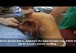 Syria war - amputate the injured man leg (graphic content) 1