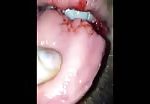 Bite your tongue 2