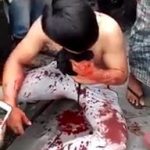 [Aftermath] Durian seller stabbed 5 times by snatchers 2