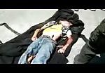 Boy ran over by a bus in yemen 3
