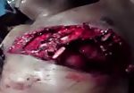Visible man heart beating through severed chest 2