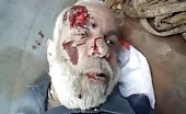 Old man dead in bombing 11