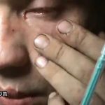 Man with Schizophrenia destroys his eye 3