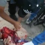 Man cut open and gets his organ eaten alive 1