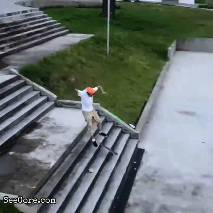 Skater snaps his ankle 16