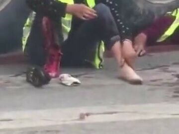 Woman with a torn foot grieving next to her crushed partner 8