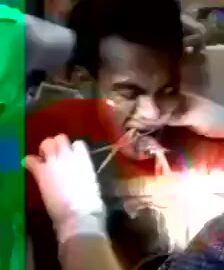 Man gored by a fish in his throat 5