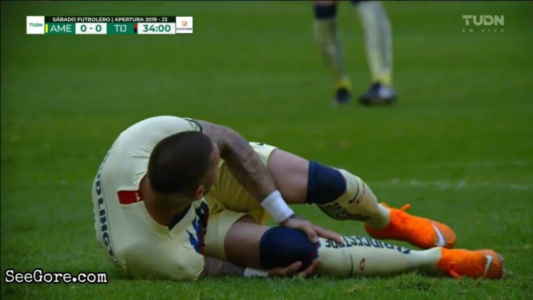 Compilation of football injuries 19