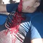 Guy vomits blood after being shot in the face 4