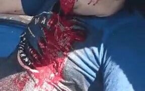Guy vomits blood after being shot in the face 19