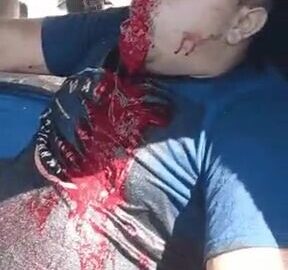 Guy vomits blood after being shot in the face 20