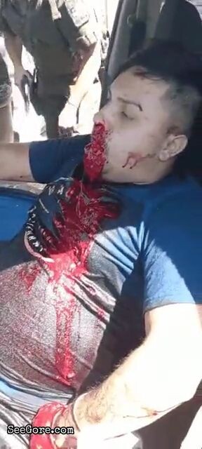 Guy vomits blood after being shot in the face 4