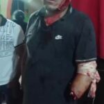 Man loses hand after being attacked with a machete 2