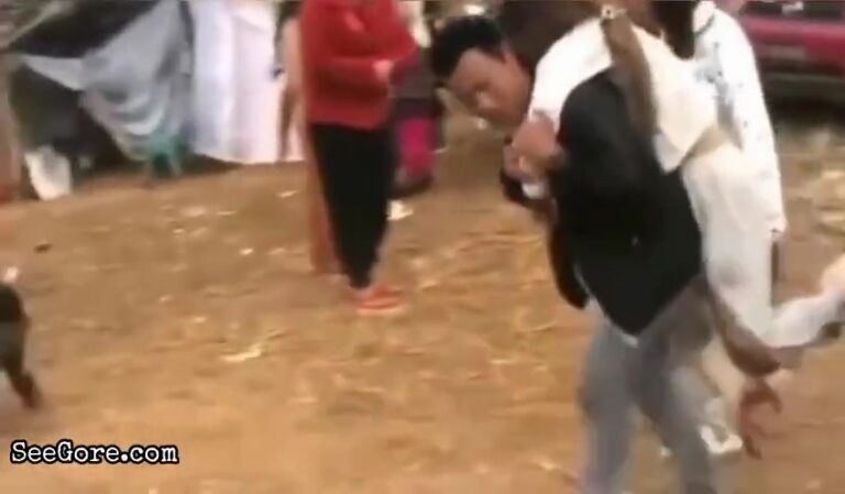 Burmese army's landmine blown a girl's legs 21