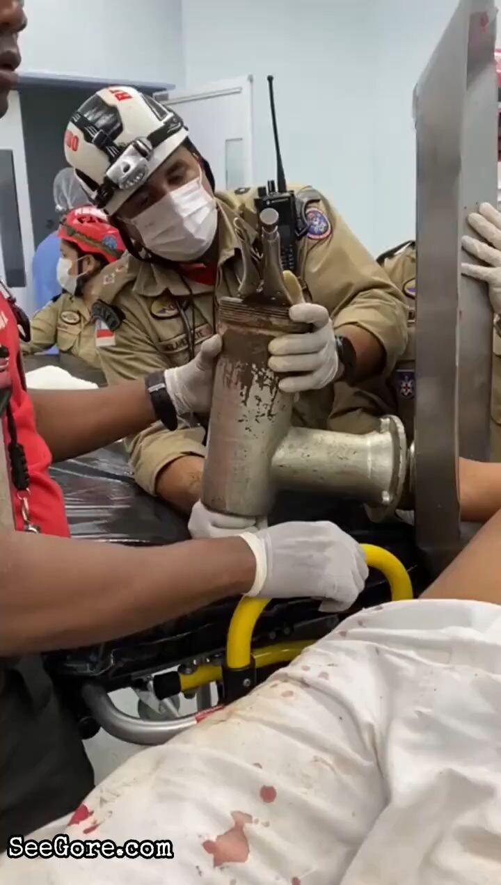 Hand stuck in machine part 11
