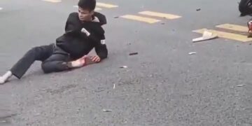 Leg crushed in an accident 11
