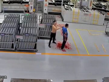 Guy loses both arms at work 6