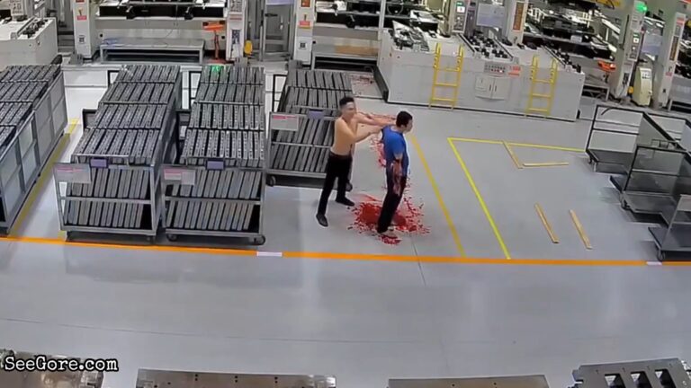 Guy loses both arms at work 24