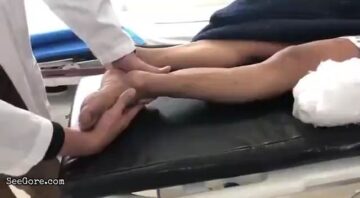 Fixing a Dislocated Ankle 1