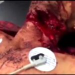 Man With Slashed Throat Still Alive 2