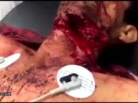 Man With Slashed Throat Still Alive 10