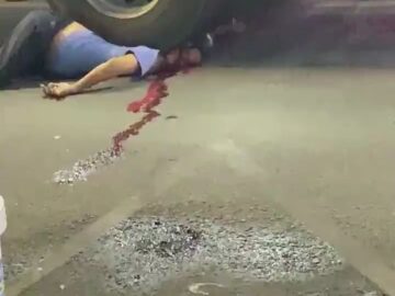 Man Crushed Under Truck Tyres 4