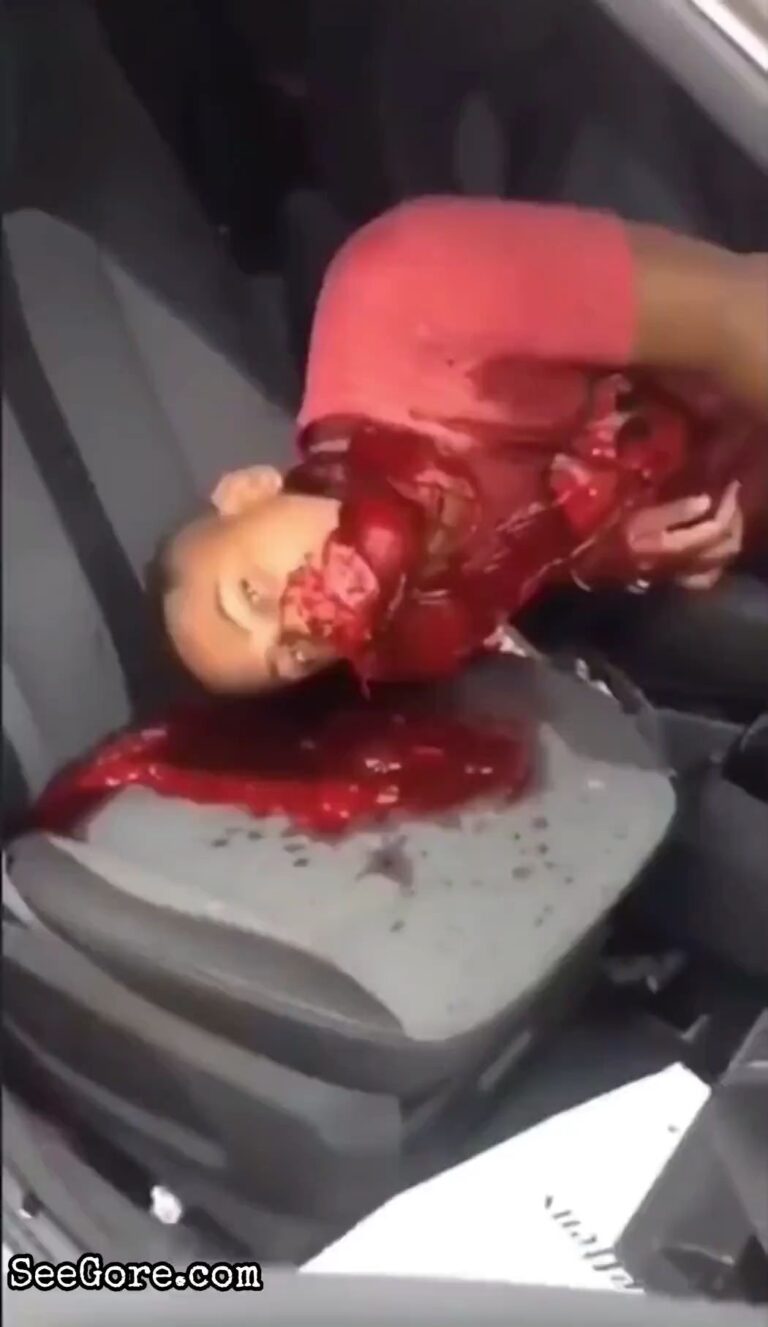 Man Suffers Serious Injuries in an Accident 3