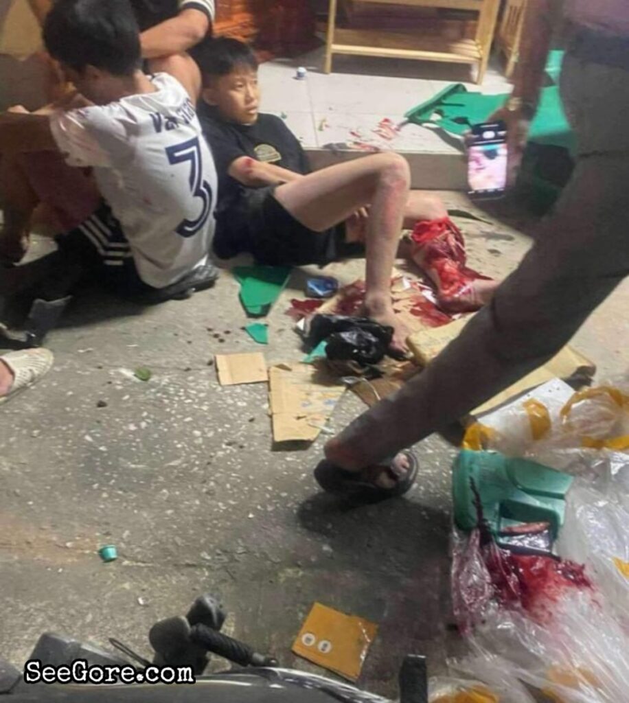 Kids Crashes and Tear the Leg of One of Them 4