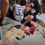 Kids Crashes and Tear the Leg of One of Them 1