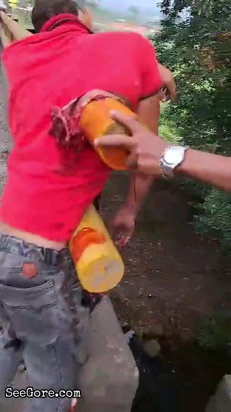 Man Impaled by a Big-Ass Road Divider 12