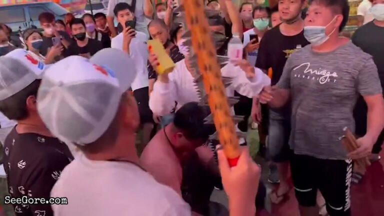 Man Hit Himself With a Long and Shiny Saw 13