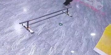 Broken Ribs by Falling While Skating 20