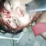 Men Shoves Machete Into the Face of a Dead Woman 1