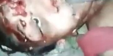 Men Shoves Machete Into the Face of a Dead Woman 14