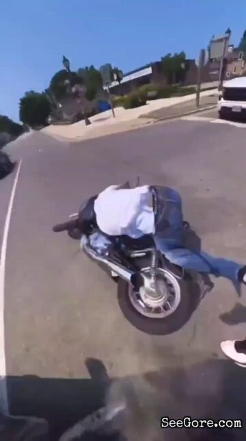 Biker's Bone Sticking Out After a Nasty Accident 1